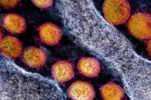 Un equipo del CSIC busca una vacuna para el COVID-19 que usa un antígeno del coronavirus para estimular la inmunidad