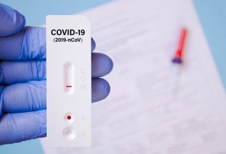 El autotest Covid-19 se dispensarán siempre con receta médica