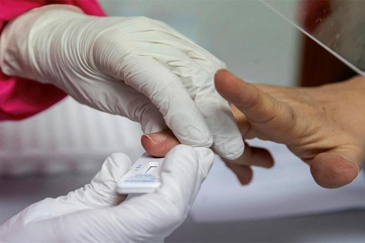 España ha realizado más de 24,8 millones de pruebas diagnósticas desde el inicio de la epidemia por COVID-19