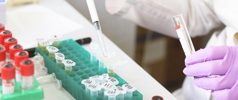 El Laboratorio Regional de Sanidad Animal, listo para la realización de analíticas PCR para detectar el virus que causa el Covid-19