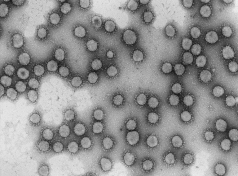 Un solo genotipo del coronavirus gener? el 60% de los casos en la primera semana de marzo