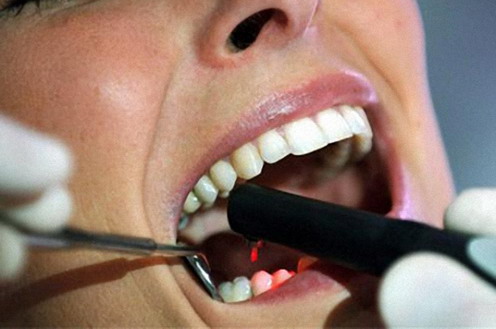 Consumo defender? los derechos de los usuarios tras el cierre de Dentix