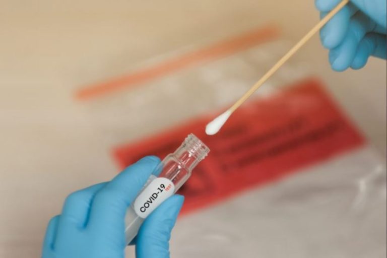 Toméa de muestras PCR centralizadas desde el veh?culo y en espacios abiertos