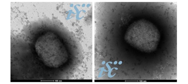 El ISCIII obtiene la secuencia completa del genoma del virus de la viruela del mono