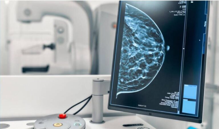 Castilla y León apuesta por la inteligencia artificial para detectar antes el cáncer de mama