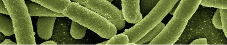 Detectan listeria en productos cárnicos españoles